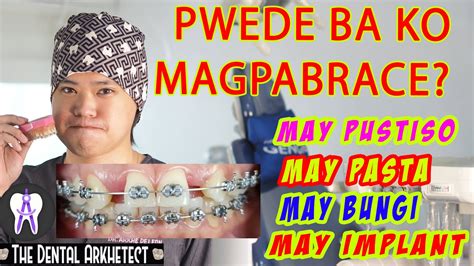 nilasing saka iniskoran si ate naka brace|May Pustiso Gustong Magpabraces .